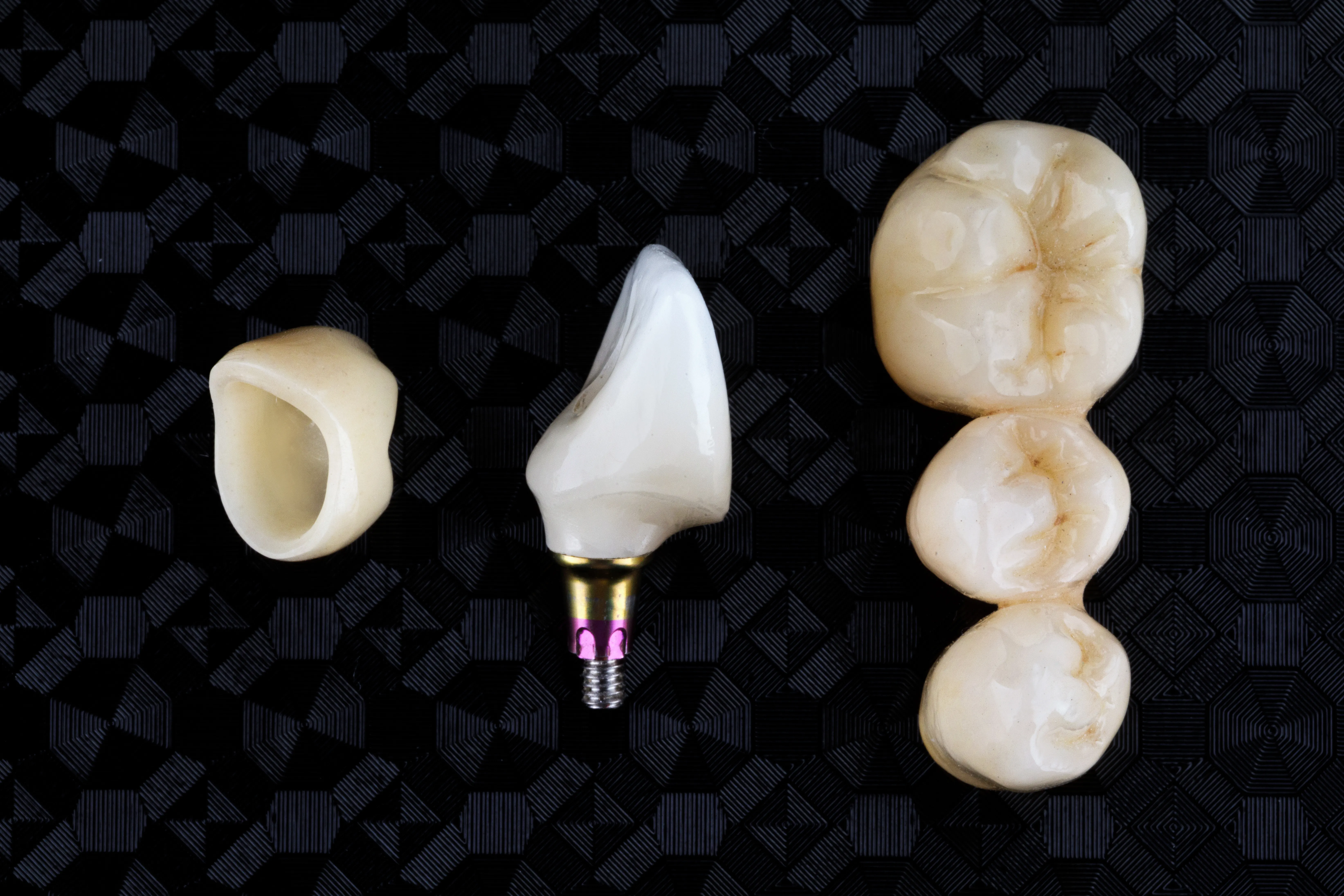 Implant-Supported Zirconia Crowns
