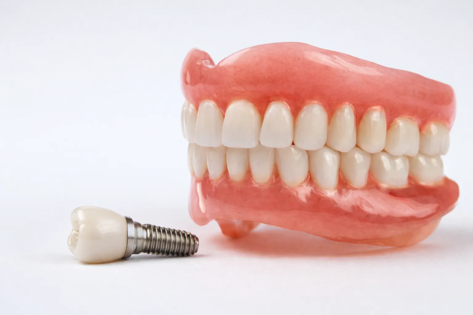 Implantat oder Prothese – was ist besser?